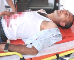 Kredi kartının limiti yetmedi, bıçaklandı