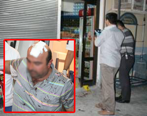Gaspçılara direndi başından yaralandı
