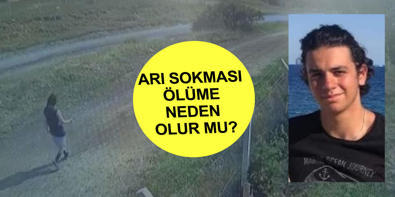 Arı sokması öldürür mü? Arı sokmasında ilk yapılacak tedavi nedir?