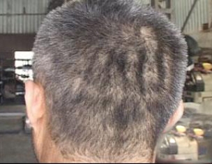 Kafasında 'Allah' yazıyor