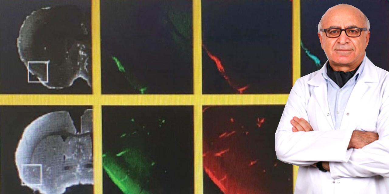 Türk cerrah Prof. Dr. Gökhan Akdemir Alzheimer’ın şifresini çözdü!