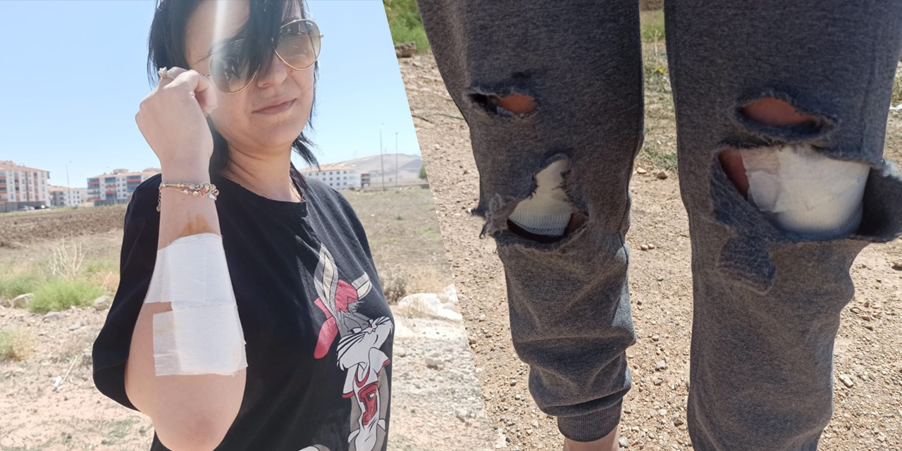 Ankara'da dehşet! Köpek sürüsünün saldırısına uğrayan kadın canını zor kurtardı