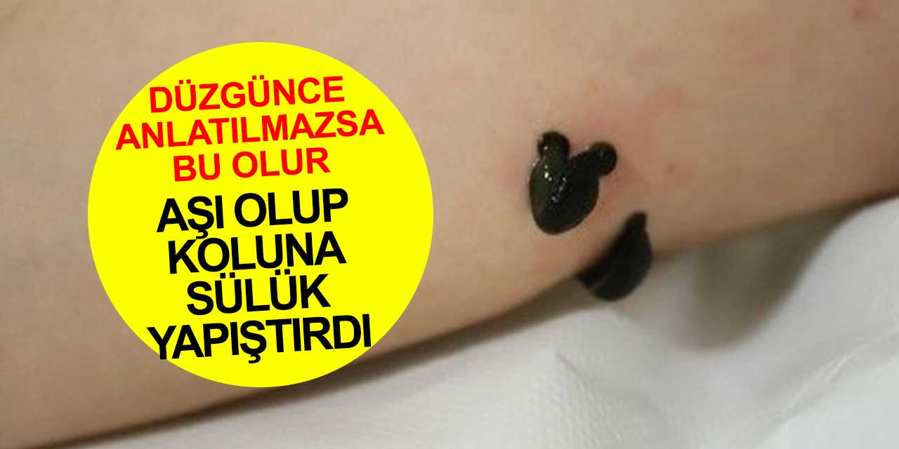 Koronavirüste aşı sorunsalı sürüyor! Düzgünce anlatılmayan aşıya güvensizlikten sülükle hastaneye geldi