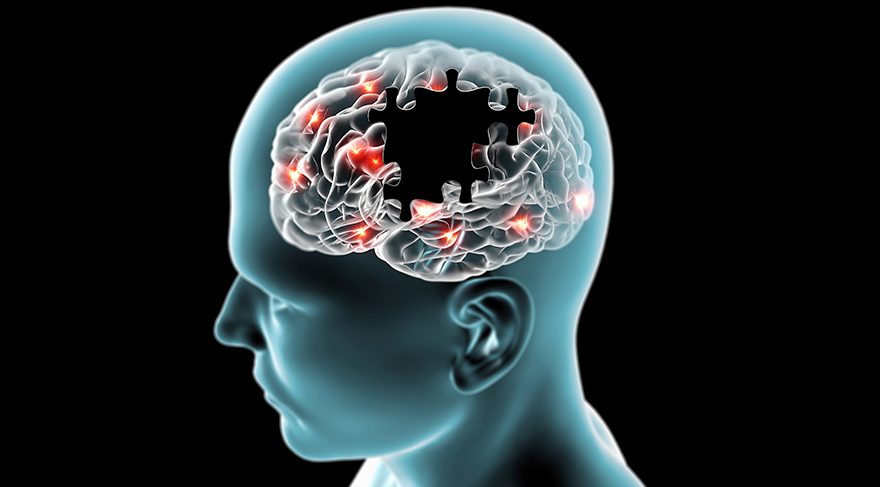 Unutkanlık hastalığı Alzheimer en çok erkekte mi yoksa kadında mı görülüyor?