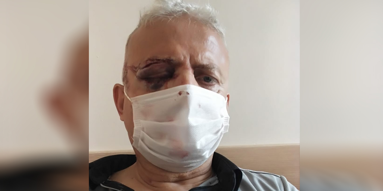 Maske uyarısında bulunduğu için darp edilen güvenlik görevlisi görme yetisini kaybetti
