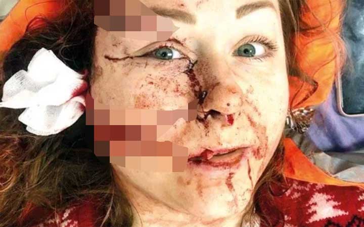 Hanna Butym'i bu hale getiren saldırgan Mesut Öztürkmen'in cezası belli oldu
