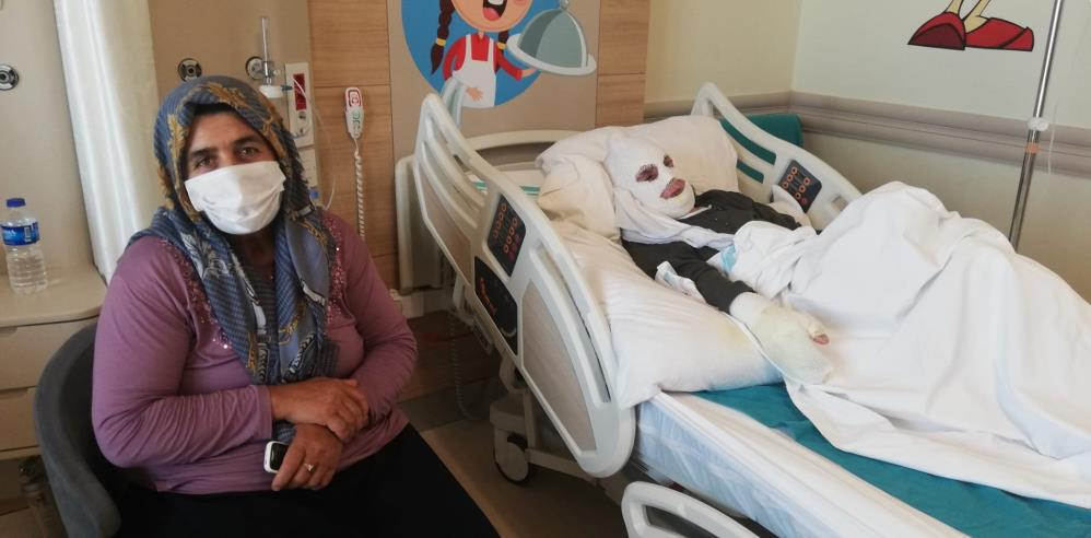 Kokuyor diye gittiği mutfakta hayatı kararan talihsiz kadının tedavisine devam ediliyor