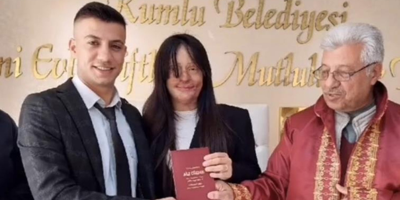 Berfin yüzünü asitle yakan eski erkek arkadaşıyla nikah masasına oturdu