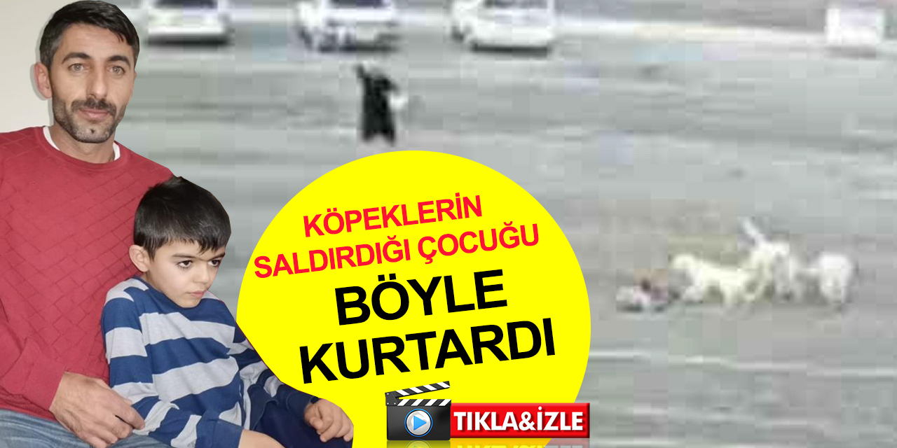 Köpeklerin saldırdığı Umut'u kurtarak kahraman kadın aranıyor!