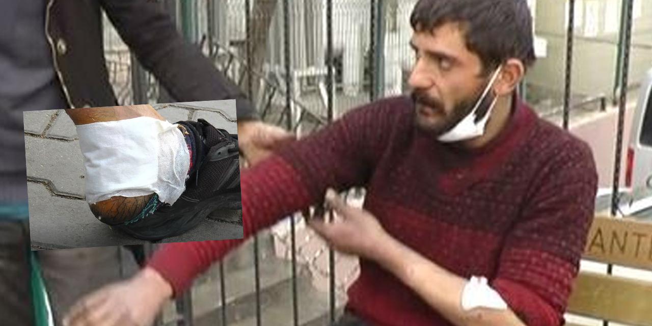 Gaziantep’te bir pitbull vakası daha! Tartıştığı adamın üstüne köpeğini saldı