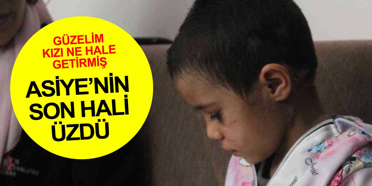 Hastaneden taburcu edilen minik Asiye'nin son hali görüntülendi