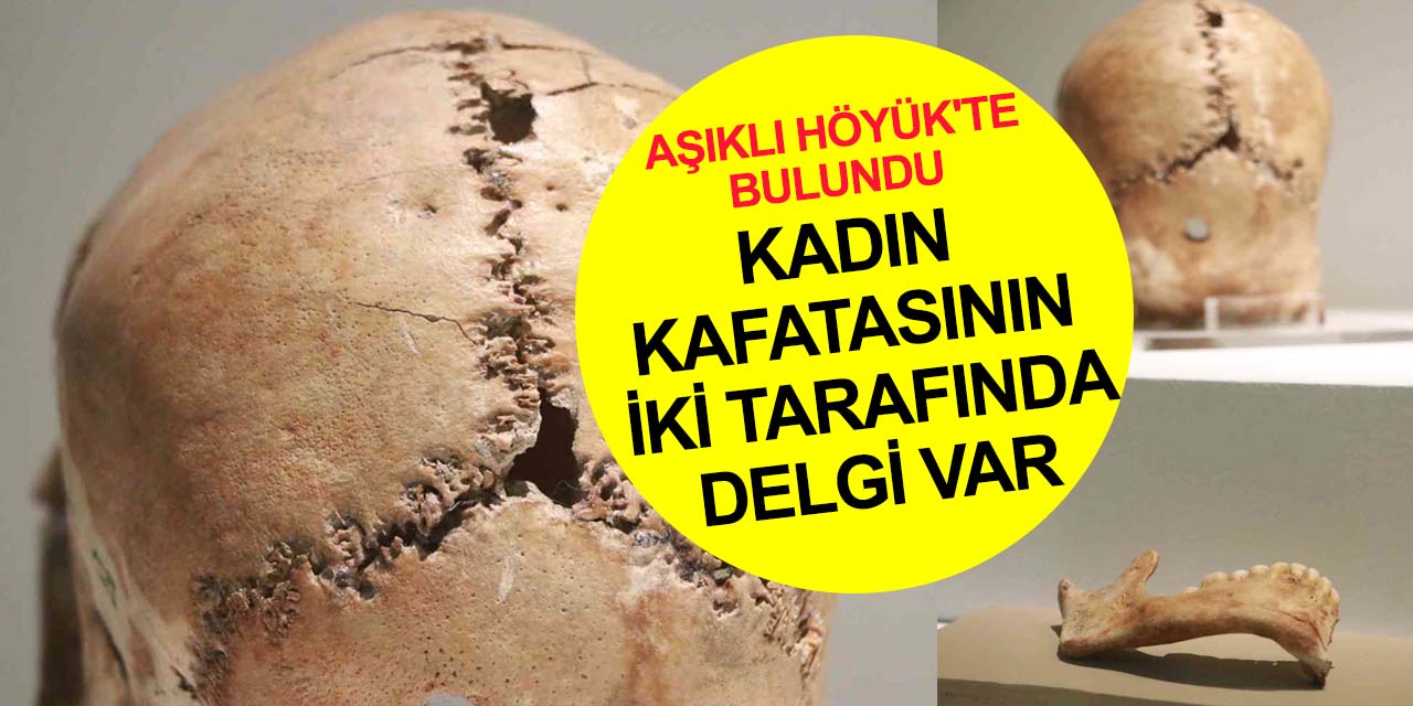 Aksaray'da bulunan 10 bin 500 yıllık kafatasının sırrı ne?