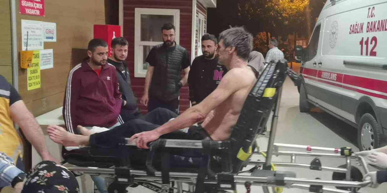 Fabrikada üzerine asit püsküren işçinin vücudunun yüzde 60'ı yandı