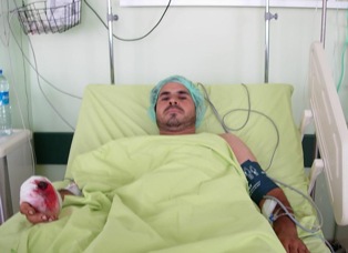 Kopan parmak yerine dikildi