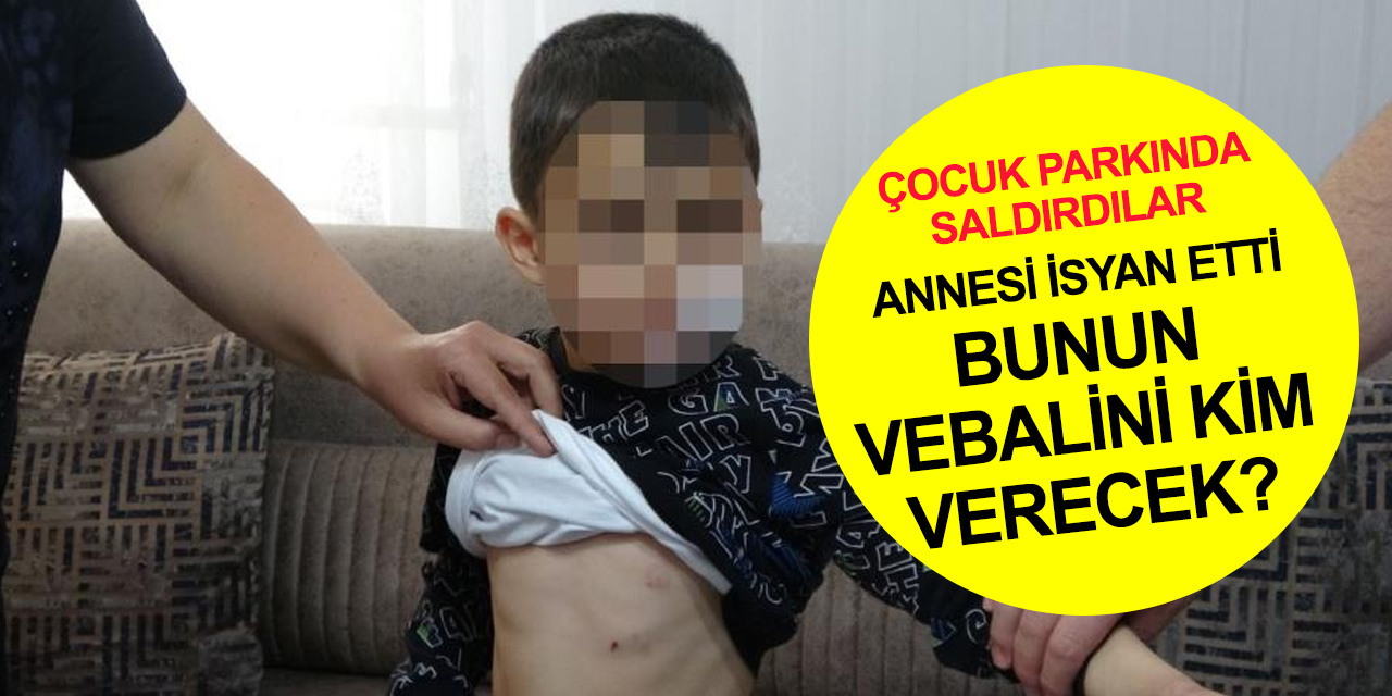 Başıboş köpek terörü bitmiyor! Çocuk parkında saldırıya uğrayan 6 yaşındaki Yiğit dehşeti yaşadı