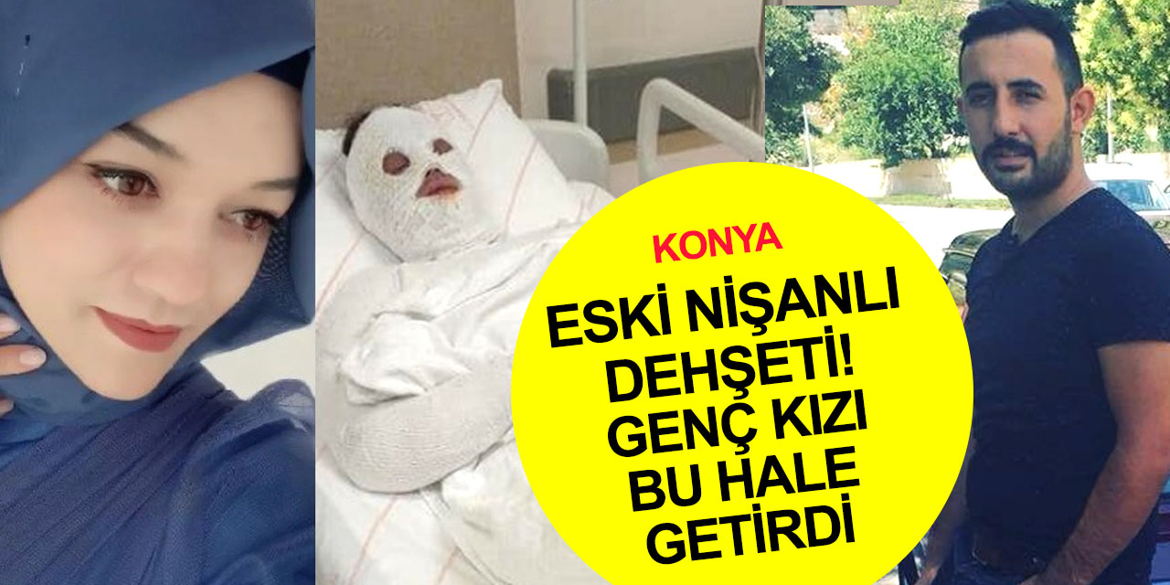 Konya Çumra'da eski nişanlıya kezzaplı saldırı olayında yeni gelişme!