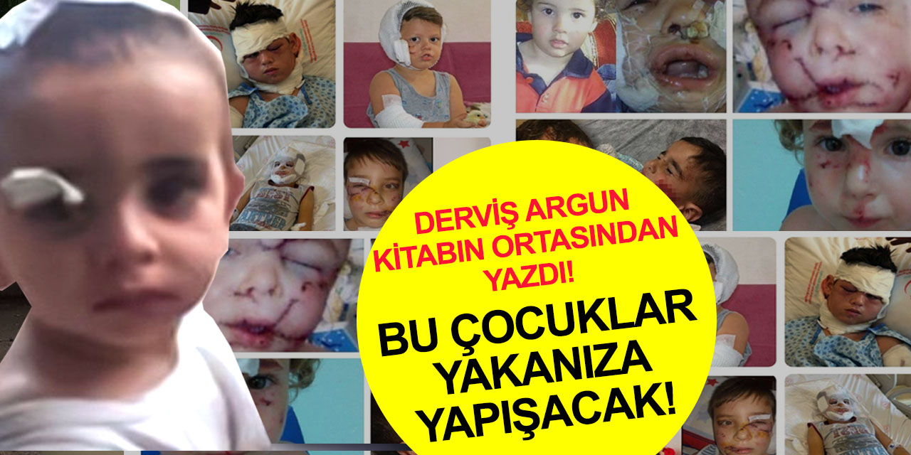 Derviş Argun kitabın ortasından yazdı: Yaşasın başıboş köpekler!