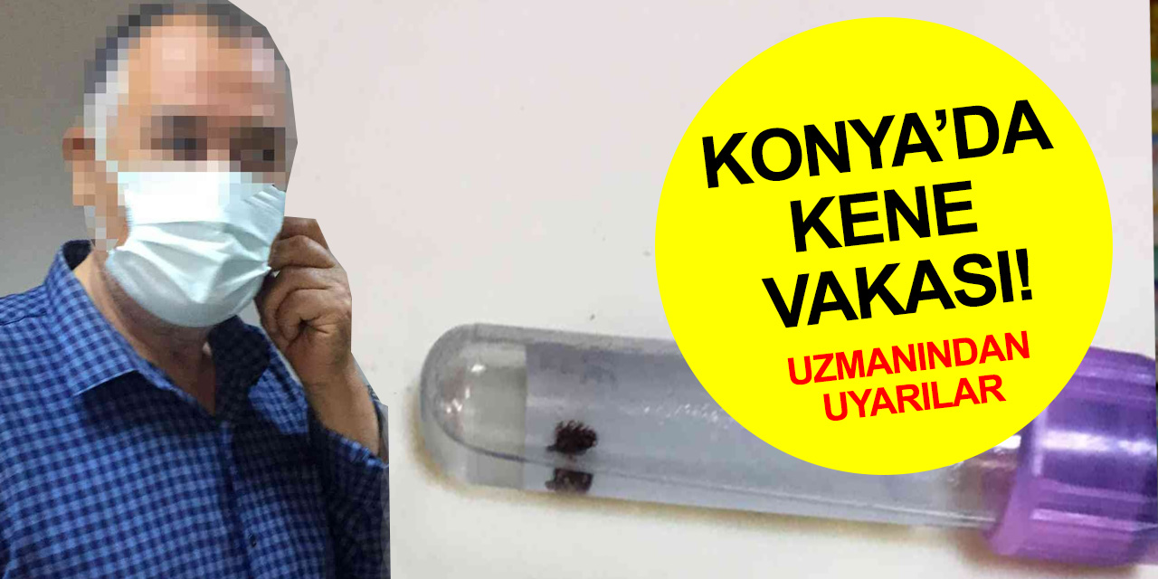Konya'da kene vakası! Kasığına yapışan kene acil serviste çıkarıldı! Uzmanı uyardı