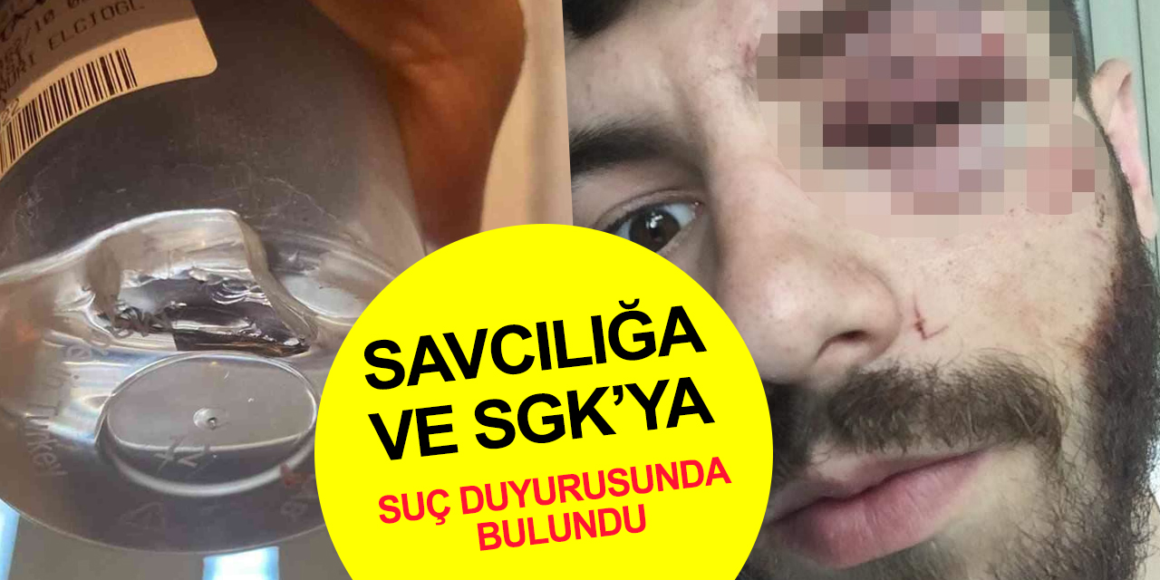 Vicdansız patron! Sigortasız çalıştırdığı işçisine maaşını da vermedi! Bardakla saldırdı..