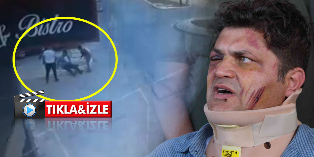 Aile Hekimi Ekin Hürel Günay'a sopalı saldırının görüntüleri ortaya çıktı