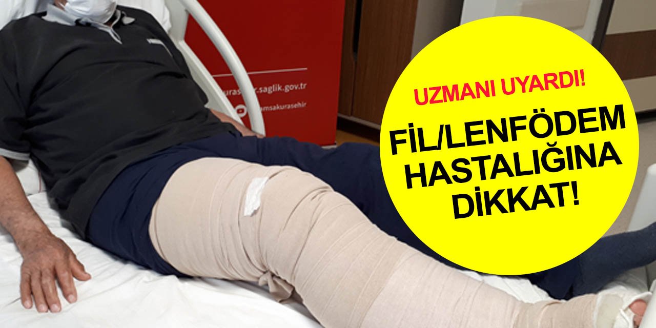 Medicana Konya Fizik Tedavi Uzmanı Dr. Bağçacı: Fil hastalığı ilerlemeden tedavi edilmeli