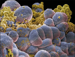 Tıp dünyası Türk doktoru konuşuyor