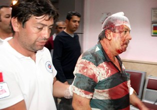 Parasını almaya gitti hastanelik oldu