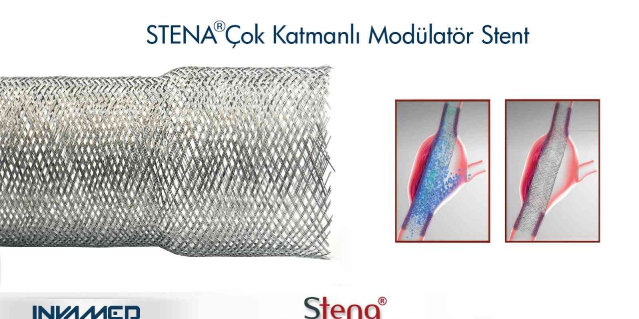 Aort anevrizmasına STENA stent tedavisi