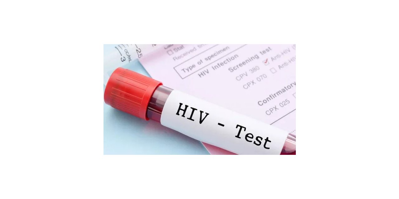 1,5 milyon yeni HIV vakası dünyayı tehdit ediyor