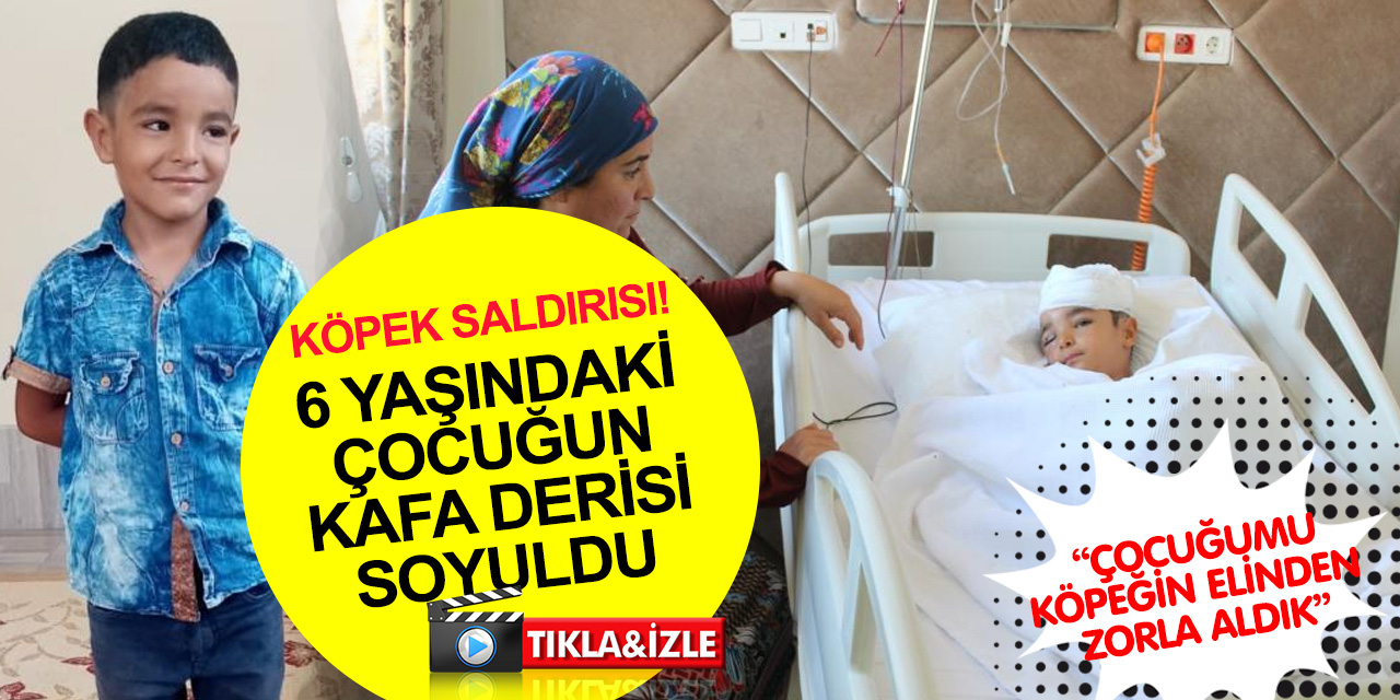 Okul dönüşü başıboş köpek saldırısına uğrayan 6 yaşındaki Nihat Can ölümden döndü!