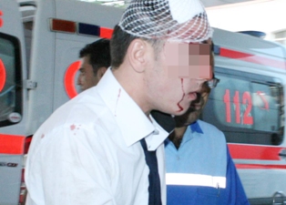 Merdivenlerden düşen lise öğrencisi yaralandı