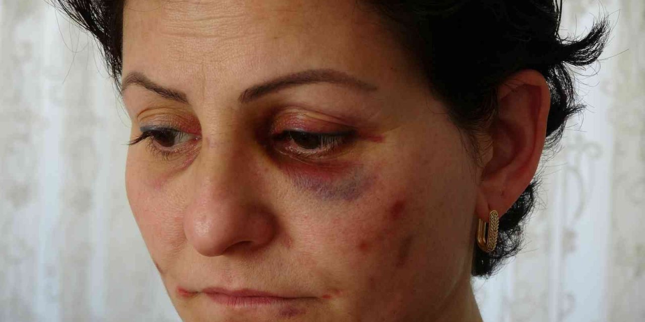 Arabayla takip ettikleri anne ve kızı döverek hastanelik ettiler