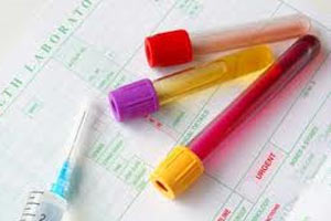 Kanserden ölümleri yüzde 50 azaltıyor