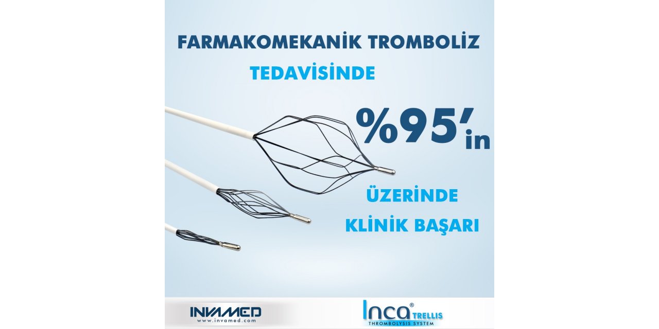 Trellis Tromboliz Sistemi ile DVT tedavisinde yüzde 95’in üzerinde klinik başarı sağlanıyor