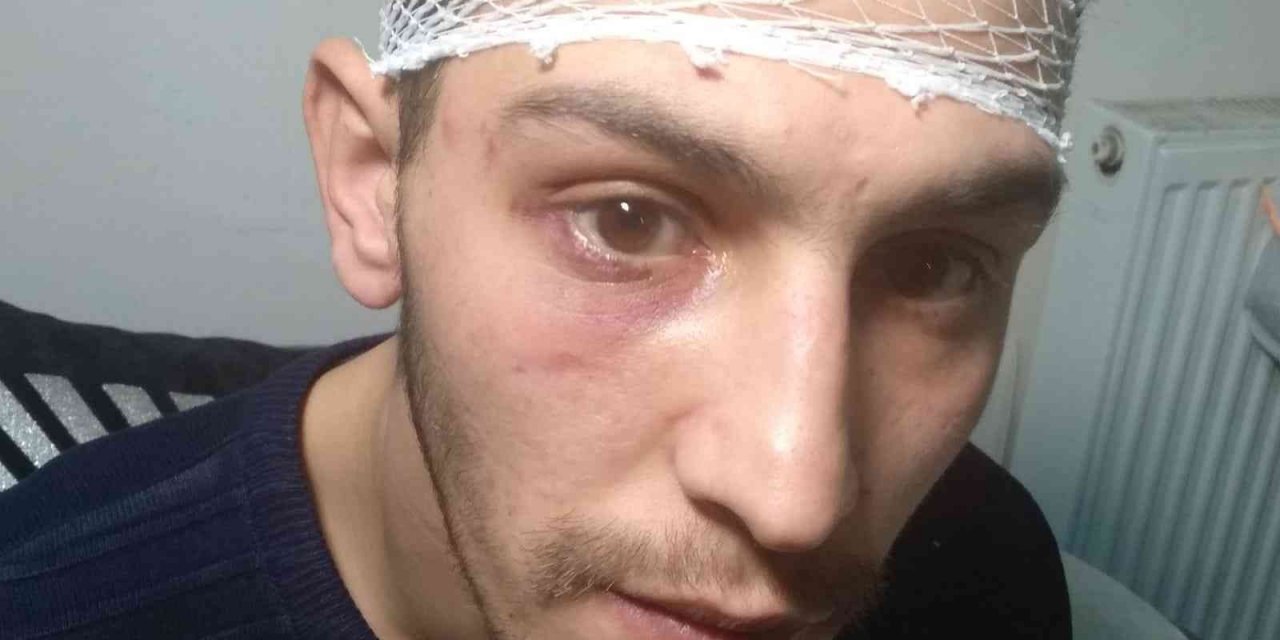 İş aramak için gittiği bölgede önce darp, ardından da gasp edildi