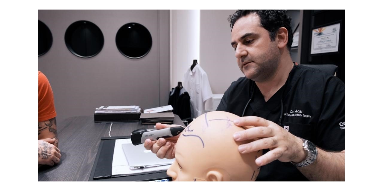 Dr. Levent Acar: "FUE saç ekim tekniği başarı garantili"