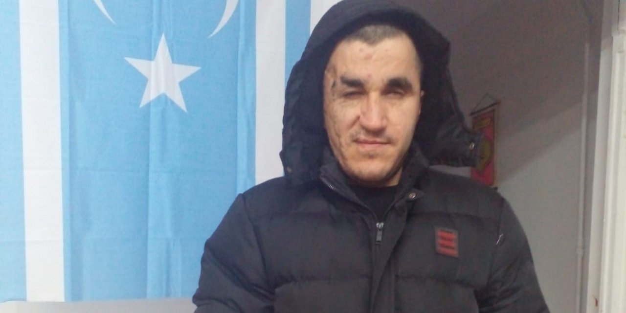 Engelli gençten örnek davranış