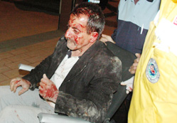 Sözlü tacizde bulununca dayak atmış