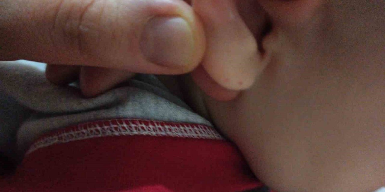 Iğdır’da eve giren yarasa, küçük iki çocuğun kulağını ısırdı