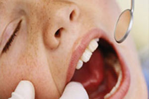 Çürümeyi önlemek için mutlaka yapın!