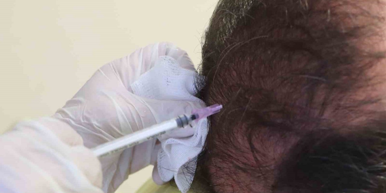 Cildiye profesöründen uyarı: “Saçkıran olan bölgeye sarımsak veya jilet sürmeyin”