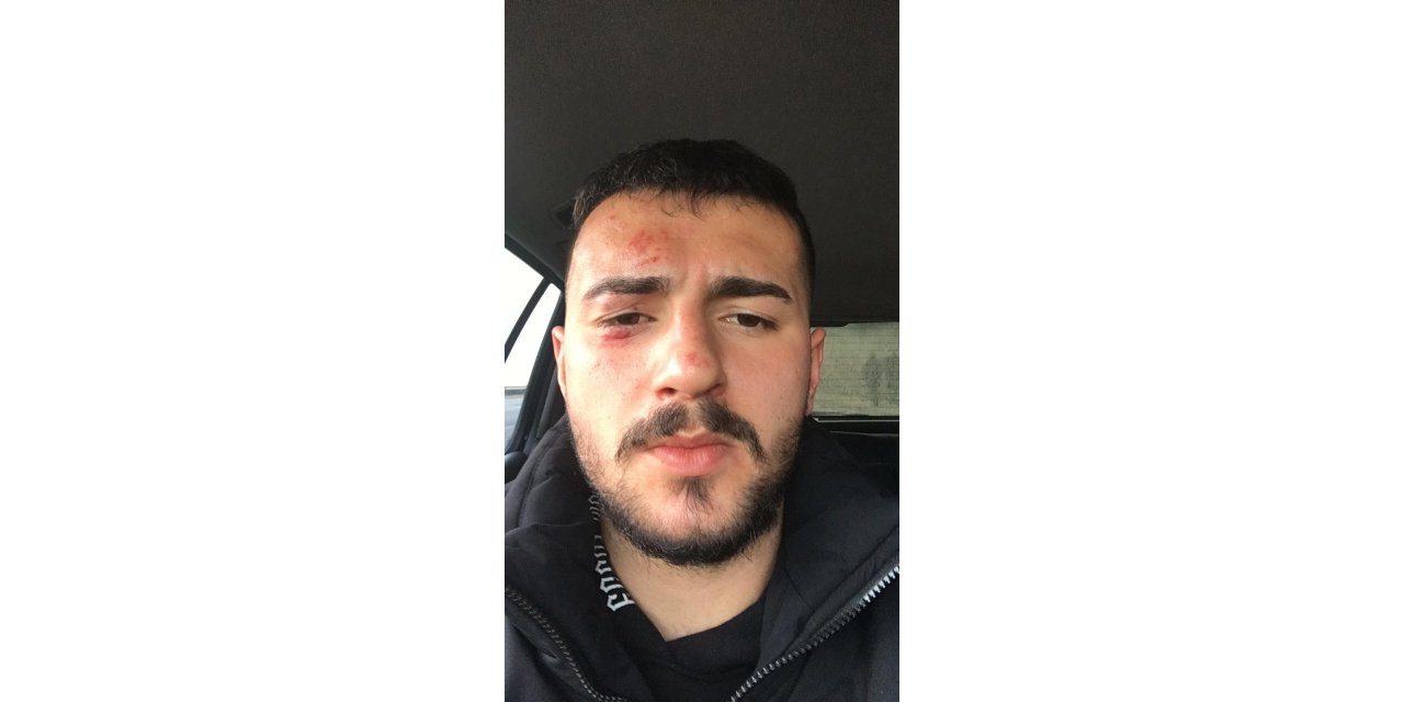 BAL ligi müsabakasında kavga