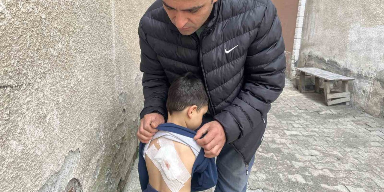 Sokak köpeklerinin saldırdığı 4 yaşındaki çocuk ölümden döndü
