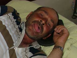 Dilini eşek arısı soktu