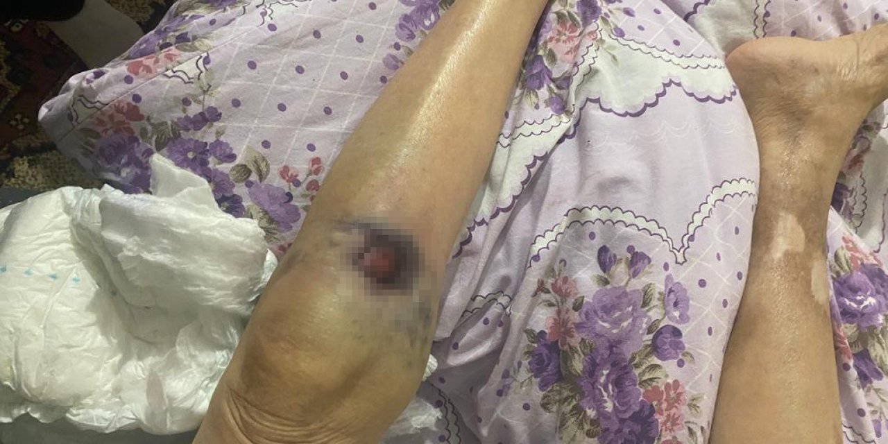 Ankara’da iki ay önce darp edildiği öne sürülen yaşlı kadın hastanede öldü