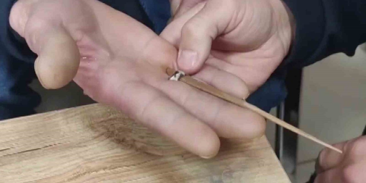 Yüzük parmağına sıkıştı, imdadına itfaiye koştu