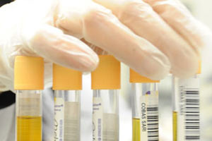 Kanserli hücrenin büyümesini önlüyor!