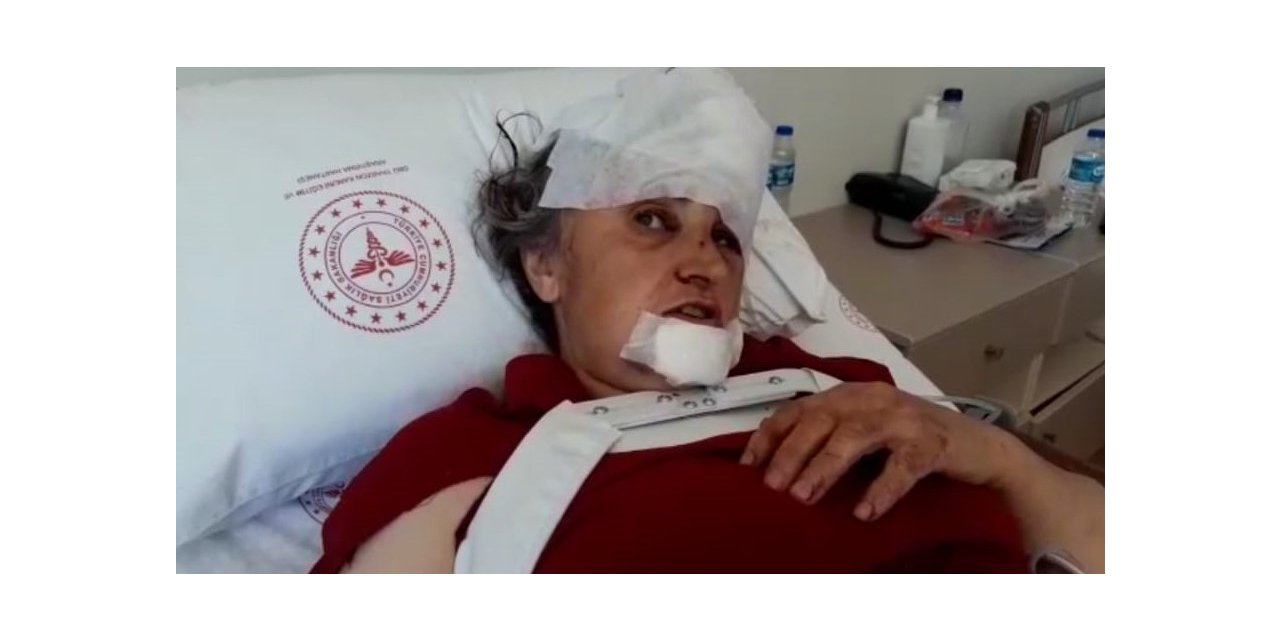 Trabzon’da 5 kişinin öldüğü, 36 kişinin de yaralandığı belediye otobüsü kazasında yaralanan yolcular kazanın şokunu yaşıyor