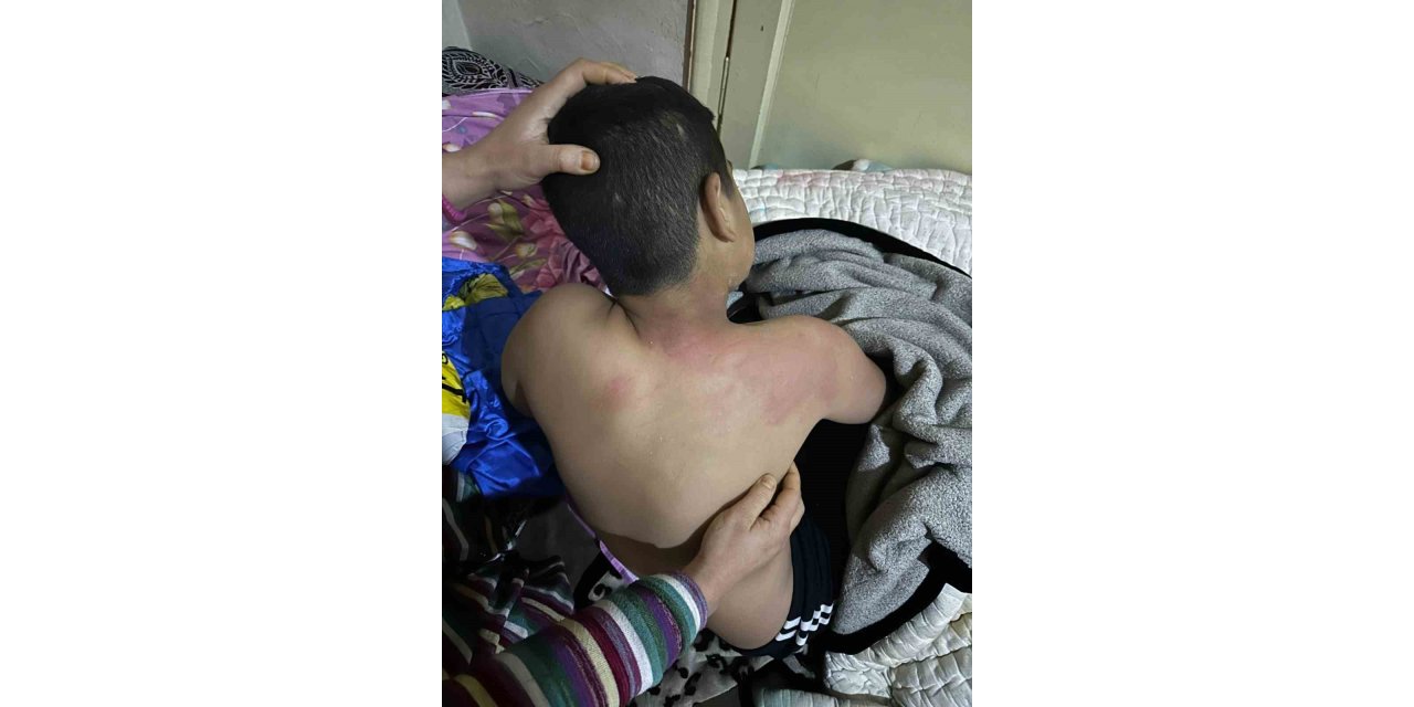 Seçim bürosuna gelen çocuğu kaynar çayla yaktı, tutuklandı