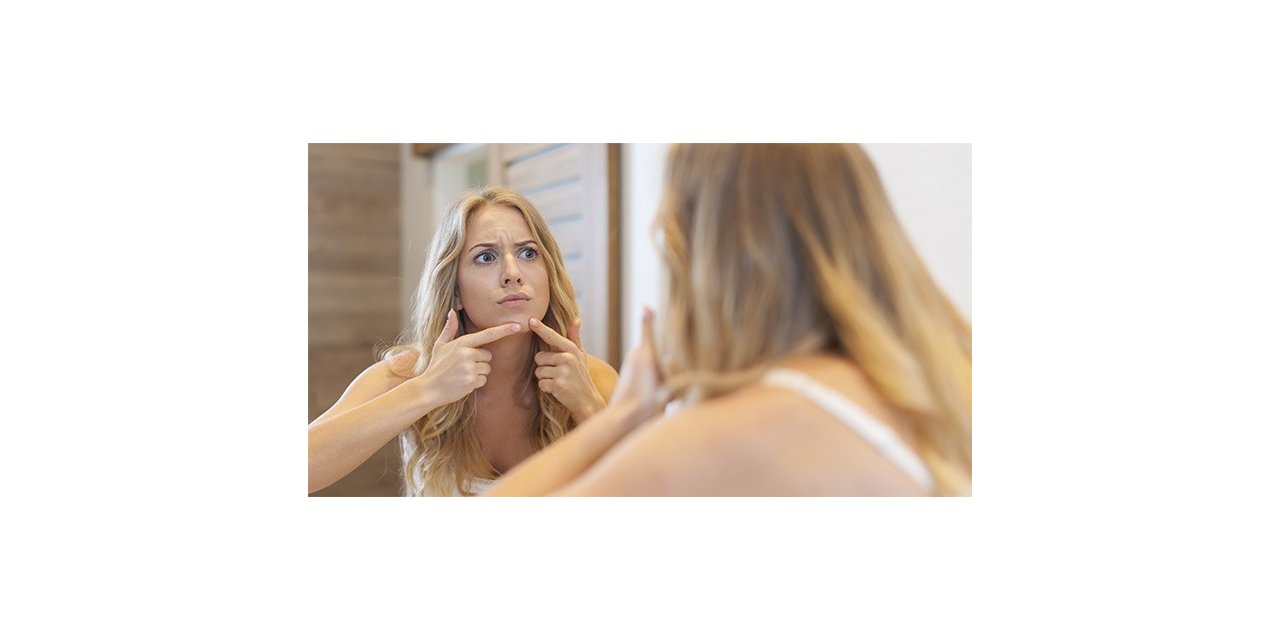 “Sivilce ergenliğe özgü bir durum değil, bir hastalıktır”